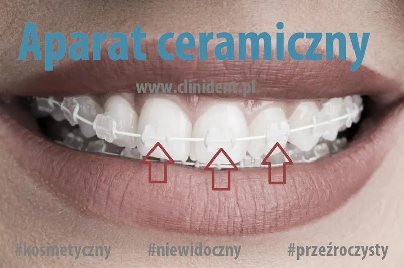 Dbanie o aparat szafirowy